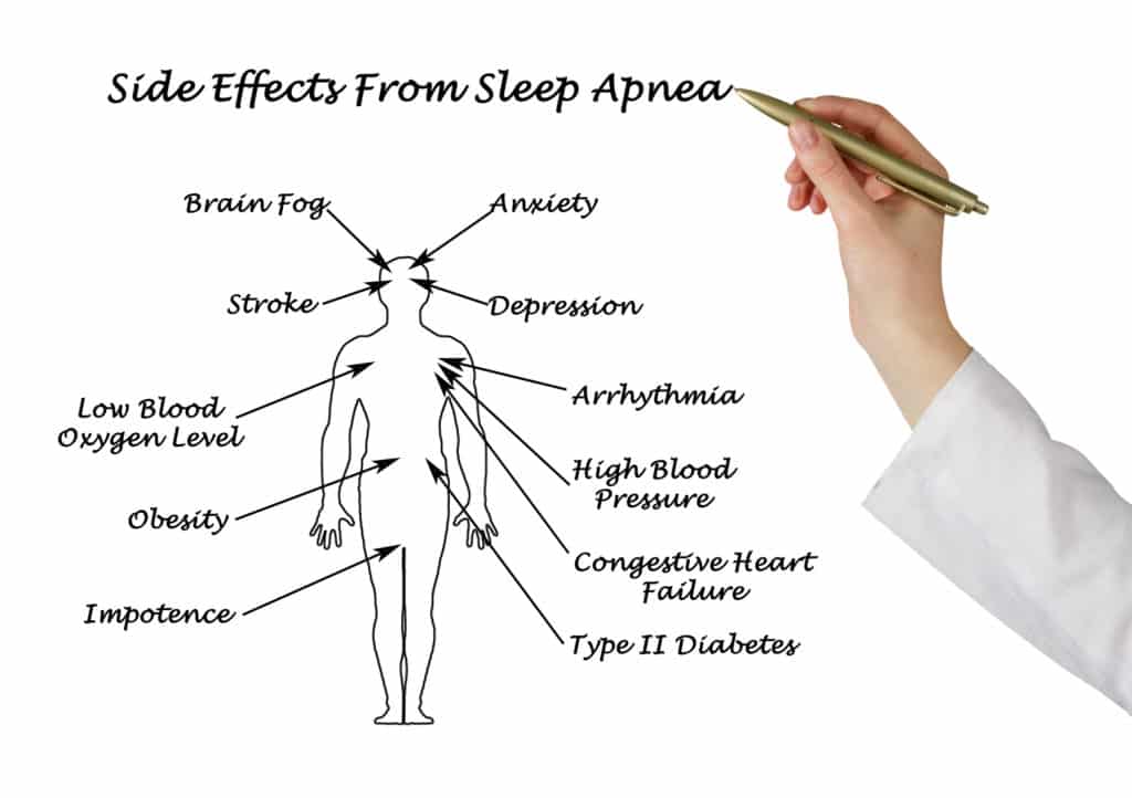 Sleep Apnea austin tx | Sinus & Snoring Specialists 