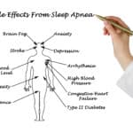 Sleep Apnea austin tx | Sinus & Snoring Specialists